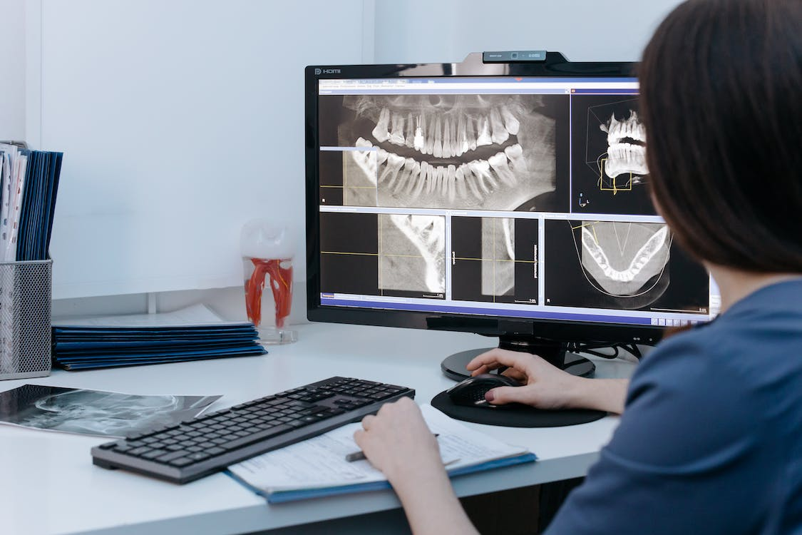 a person studying an x-ray image of teeth